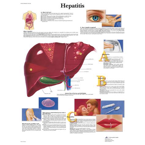 3B Scientific Hepatitis Chart