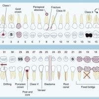 Dental Charting Symbols Cheat Sheet - Best Picture Of Chart Anyimage.Org