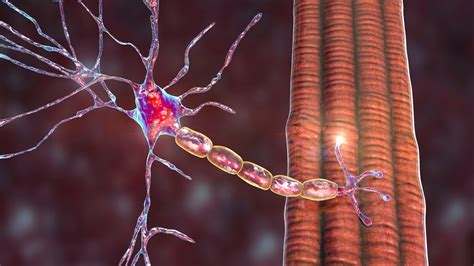 Spinal Muscular Atrophy Sma Research With Digital Pcr