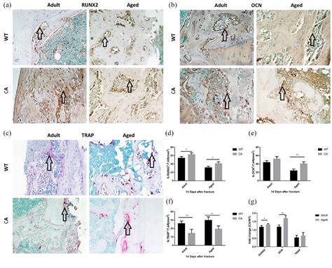 Runx2 Ocn And Trap Expression At The Defect Site On Day 14 After