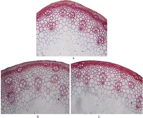 Transverse Sections Through The Median Portion Of The Main Stem Of