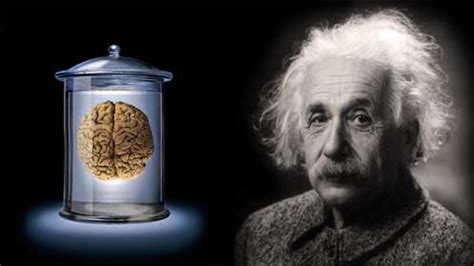 Albert Einstein S Brain Angie S Diary Guest Blog