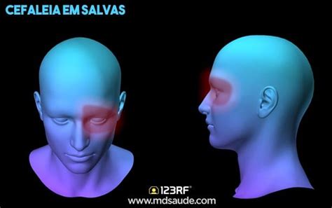 35 Tipos De Dor De Cabeça E 15 Sinais De Gravidade