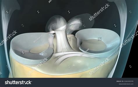 1,099 Acl Ligament Images, Stock Photos & Vectors | Shutterstock