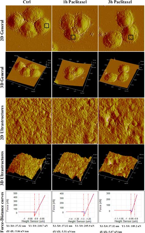 The atomic force microscopy (AFM) was used to detect the ultrastructure ...