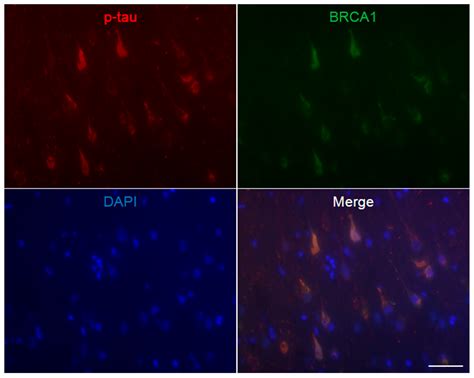 Brain Sciences Free Full Text Colocalization Of Brca With Tau