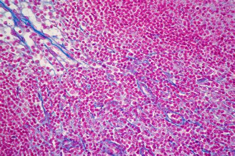 Reticular Connective Tissue