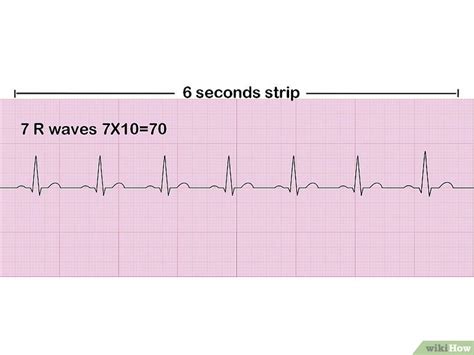 Como Ler Um Eletrocardiograma 9 Passos Com Imagens