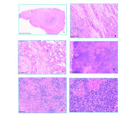 Hematoxylin and eosin staining was observed under microscope. (A) Low... | Download Scientific ...