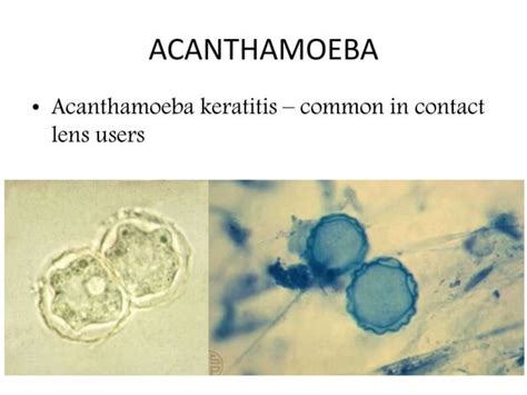 Free Living Amebae Naegleria Fowleri Acanthamoeba Balamuthia Mandrillaris Trichomonas