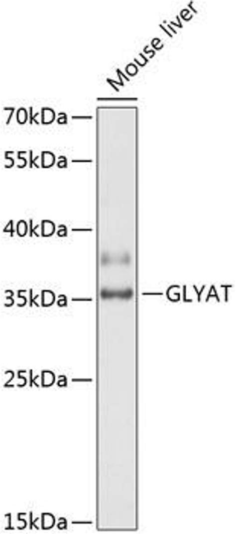 Anti Glyat 抗体 Cab14100 Assay Genie