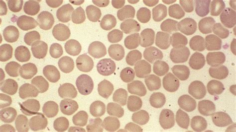 Babesia Protozoan Genus Britannica