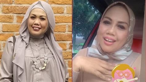 Transformasi 6 Seleb Setelah Perbaikan Gigi Terbaru Ely Sugigi Hot Liputan6