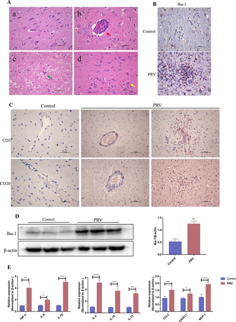 PRV Infection Induces Microglial Activation And Neuroinflammation In