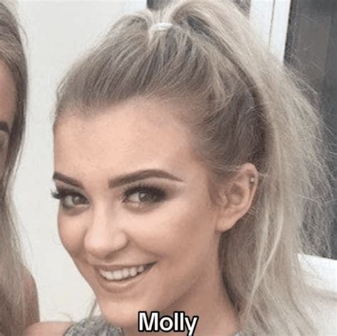 Old Pictures Show Huge Transformation Molly Marsh Had Before Love Island