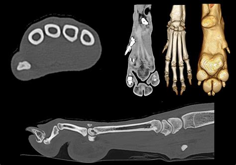 Tarsus Anatomy Of The Dog Normal Anatomy Vet-Anatomy, 50% OFF