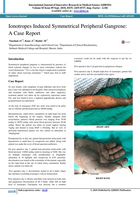 PDF Ionotropes Induced Symmetrical Peripheral Gangrene A Case Report