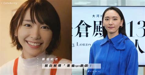 新垣結衣婚後劇集宣傳被指臉型大變？ 親自解釋「暴瘦」原因！ Girl Secret