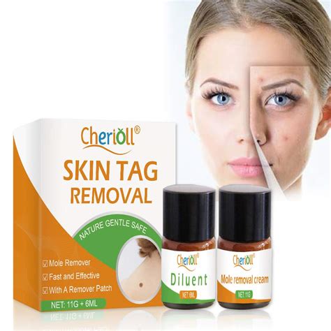 Skin Mole Removal Cream