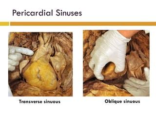 Pericardium Anatomy | PPT