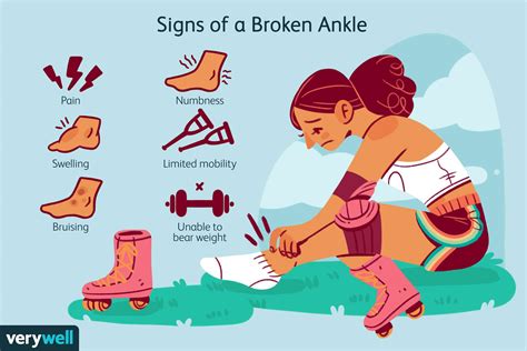 Broken Ankle Symptoms and Treatment