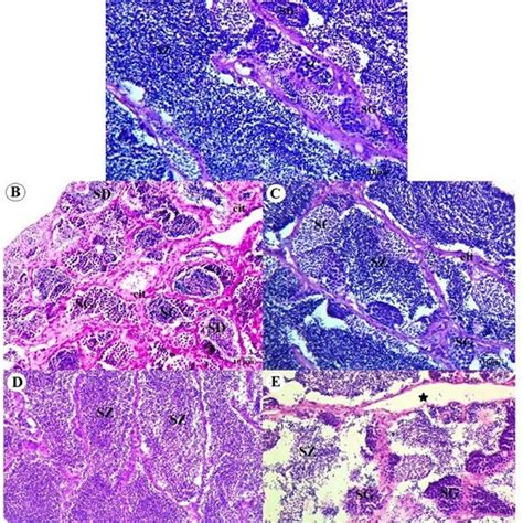 Photomicrographs Of Testis Of Anabas Testudineus Showing Different