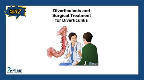 Diverticulosis and Surgical Treatment for Diverticulitis - Quiz - YouTube