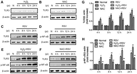 Oxidative Stress Modulates The Expression Of Tolllike Receptor 3