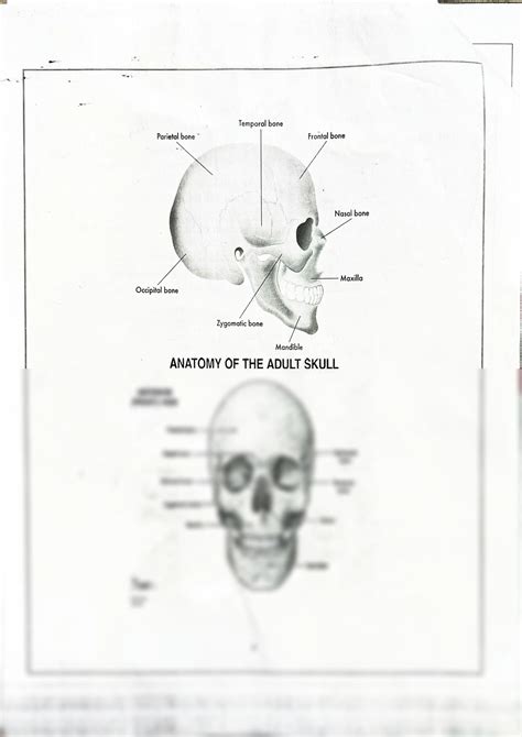 SOLUTION: Skull structure anatomy skull types of skull bones - Studypool