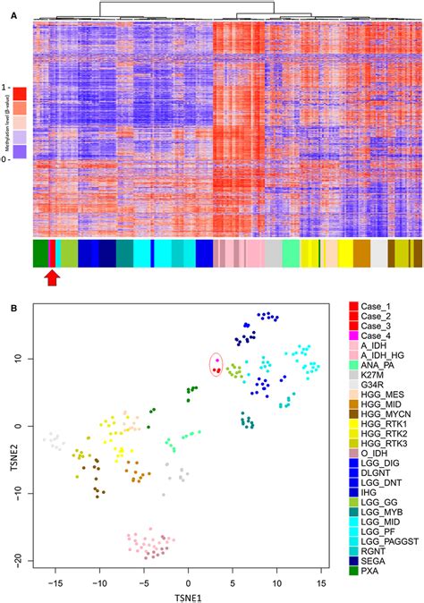 Unsupervised Hierarchical Clustering A And T‐sne Plot B Of