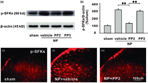 The Increased Expression Of P Sfks In Spinal Dorsal Horn Of Np Group Is