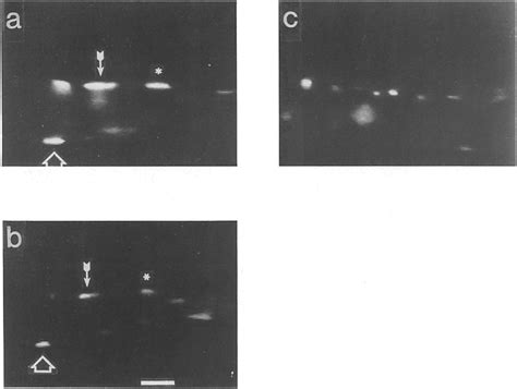 A And B Fluorescence Micrographs Of A Single Region Of A Ccd Before