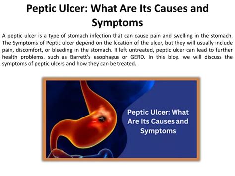 Ppt What Signs And Symptoms Indicate A Peptic Ulcer Powerpoint Presentation Id 11989151