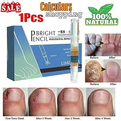 Buy Fungal Nail Treatment Pen Effective Onychomycosis Paronychia Fungus