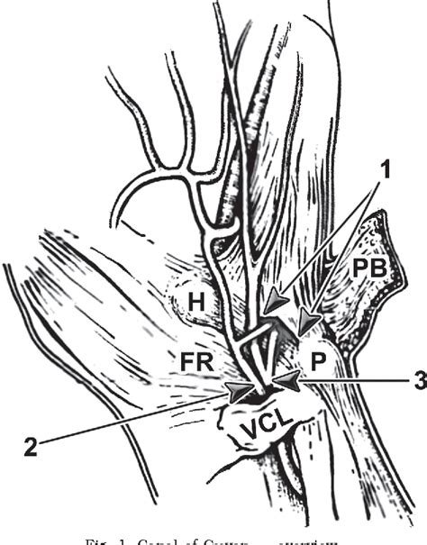 Anatomy of Guyon's canal - a systematic review. | Semantic Scholar