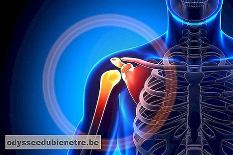 Tratamiento para el Síndrome del Hombro Congelado es odysseedubienetre be