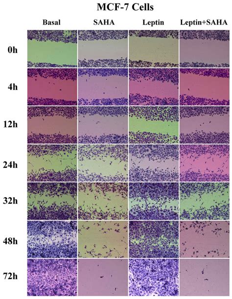 Wound Healing Assay Mcf Or Mda Mb Cell Was Plated On A Well