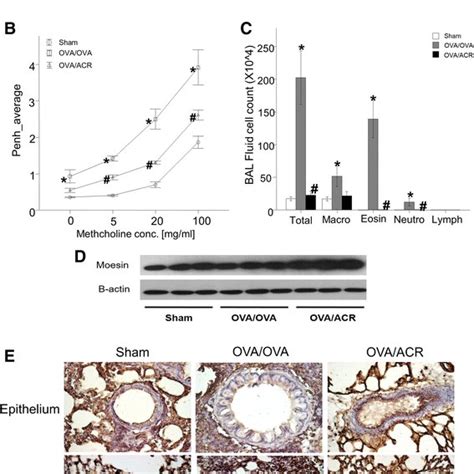 Experiment Protocol Of Asthma Model And Expression Of Moesin In Lung