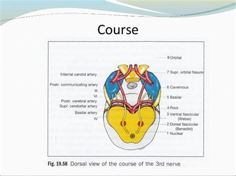 Oculomotor nerve palsy