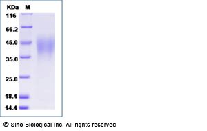 Recombinant Human Fc Epsilon Ri Protein Hnah Sino Biological