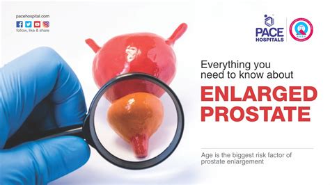 Enlarged Prostate Or Benign Prostatic Hyperplasia Bph Everything