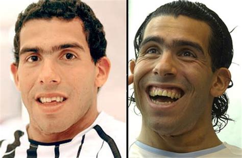 Coqueto Carlos Tévez Ya Se Entrena Con Una Nueva Sonrisa