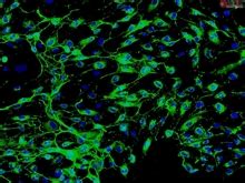 Human Myometrial Microvascular Endothelial Cells HMMEC