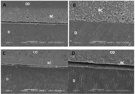 Scielo Brasil Durability Of The Adhesive Cementation To The Dentin