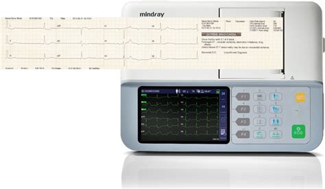 Beneheart R Ecg Machine Mindray Best Quality