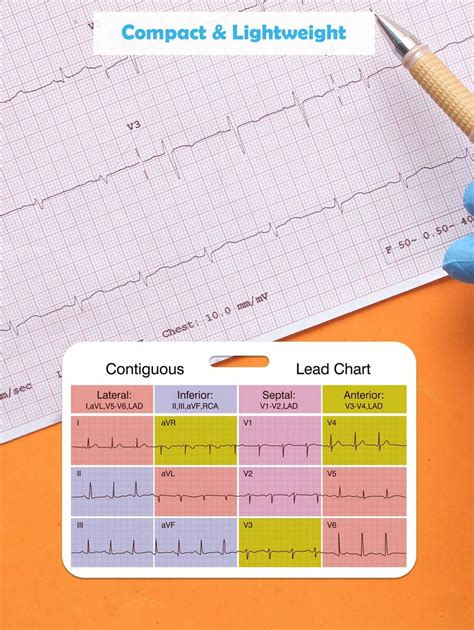 Ekg Cardiac Badge Card Card Set Stemi Badge Card Ekg Telemetry