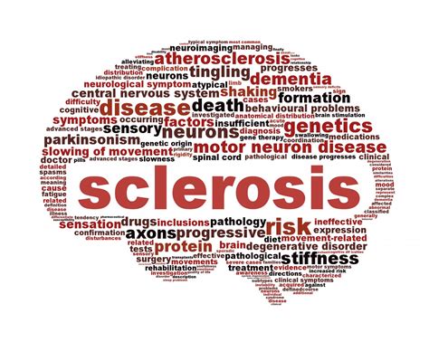 Esclerosis Multiple