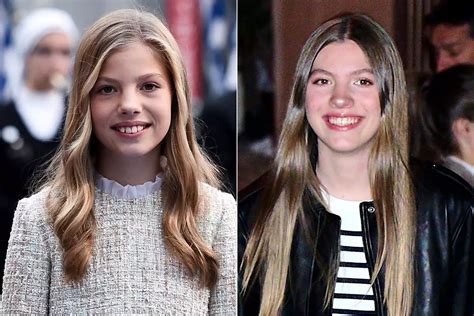 La Infanta Sofía Estrena Sonrisa Este Es Su Antes Y Después