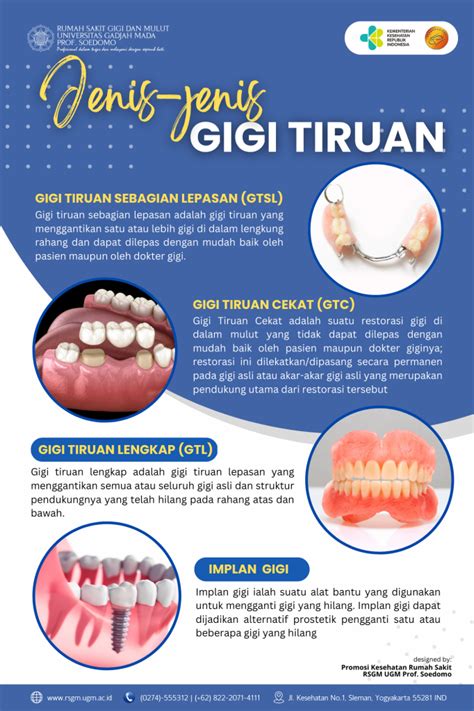 Mengenal Jenis Jenis Gigi Tiruan RSGM UGM Prof Soedomo