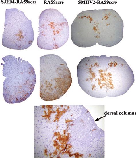 Viral Antigen Expression In Spinal Cord Sections Of Mice Infected With